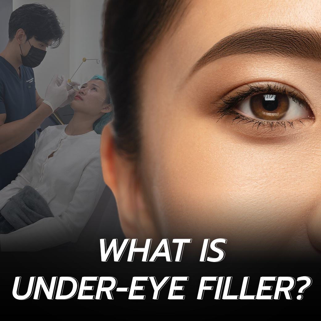 What Is Undereye Filler ?