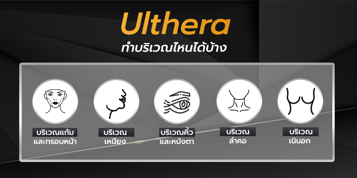 Ulthera ทำบริเวณไหนได้บ้าง
