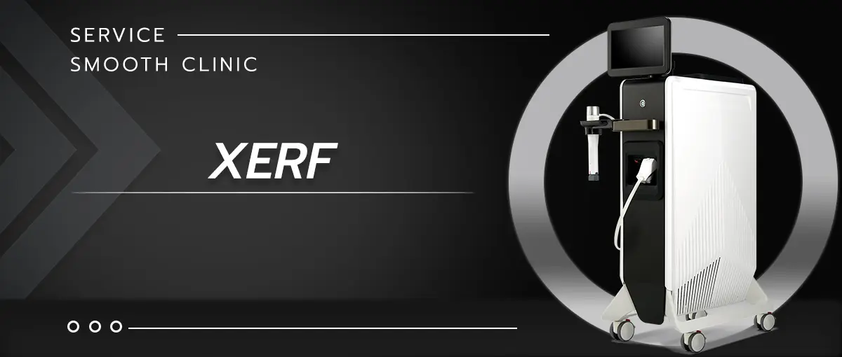 Smooth service xerf en D