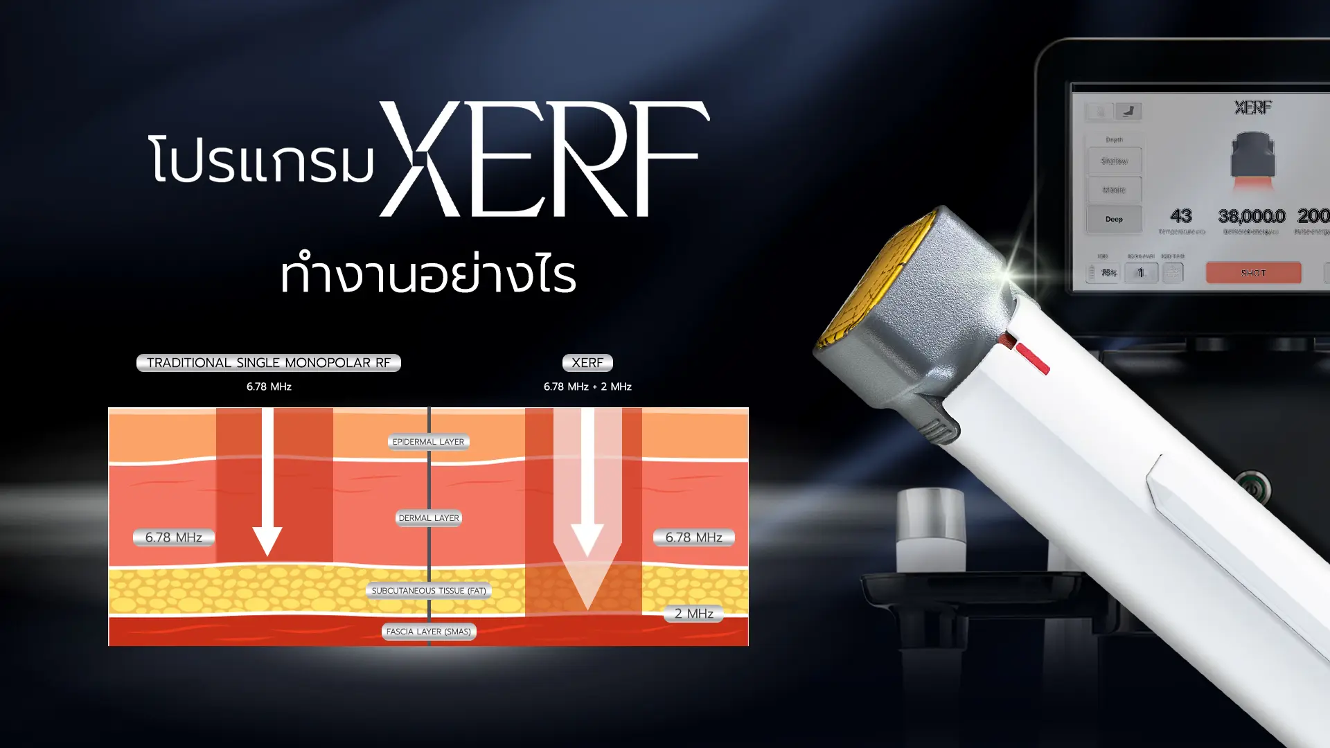 XERF ทำงานอย่างไร?