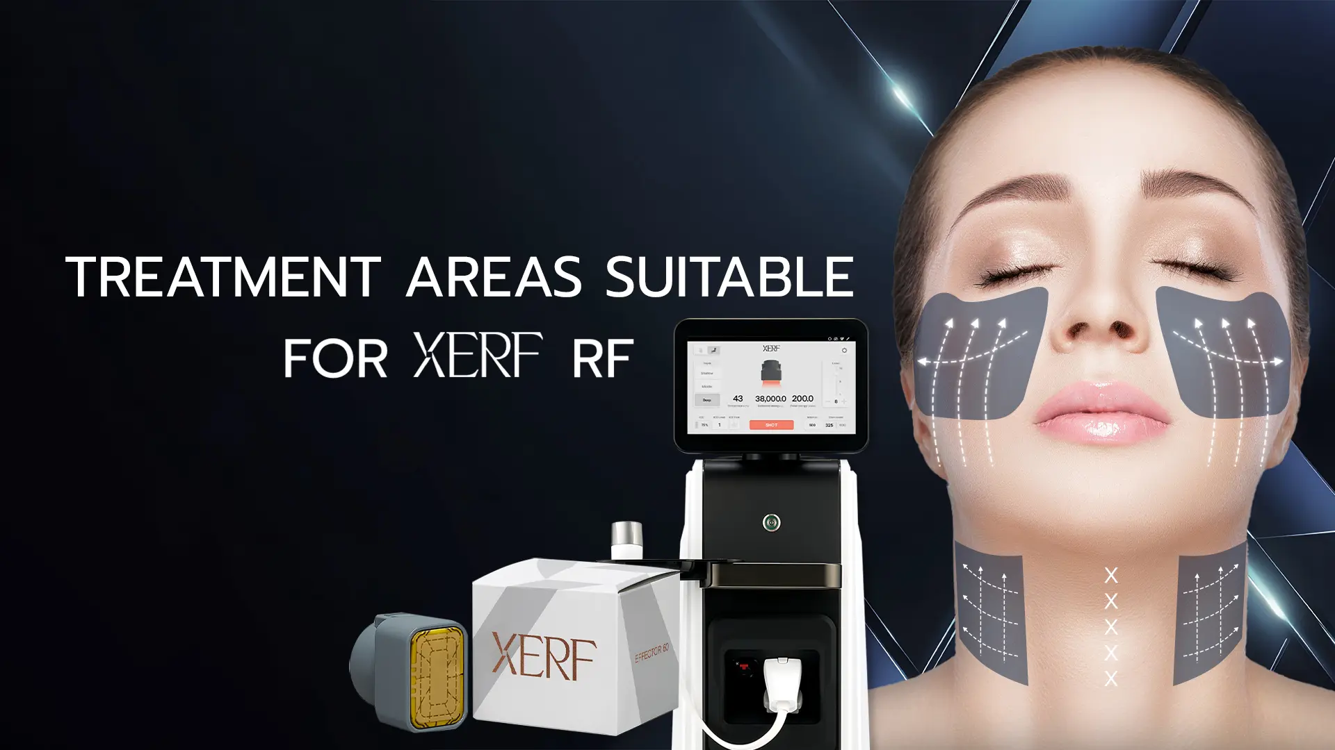 Treatment Areas Suitable for XERF RF